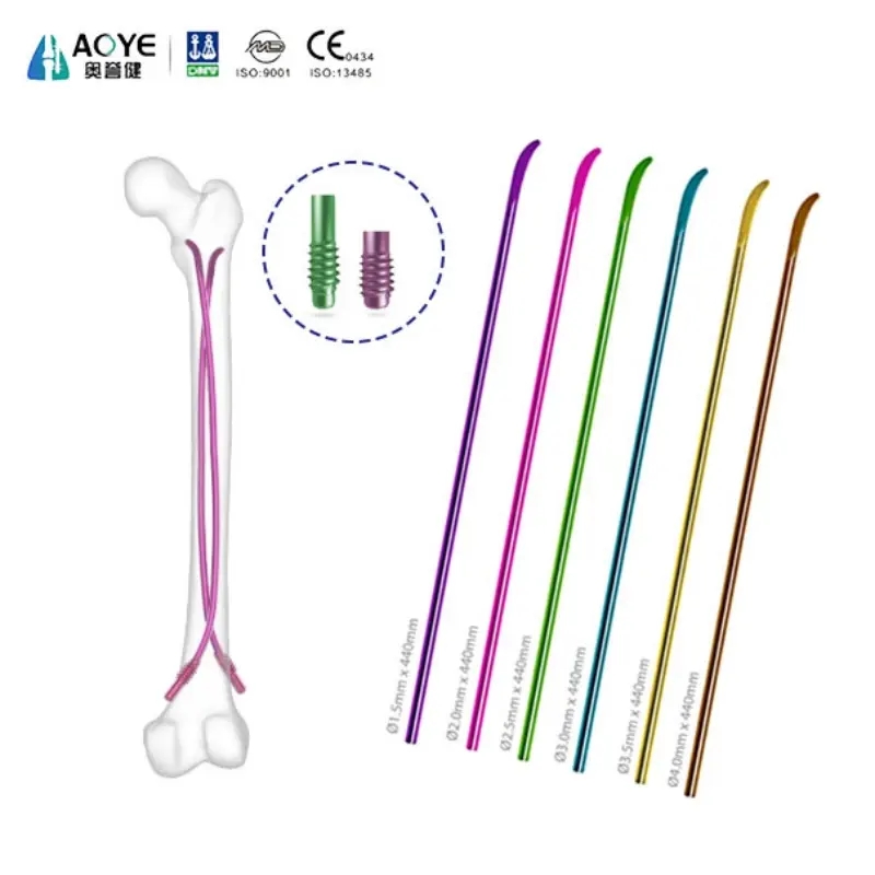 Титановый эластичный гвоздь | Гибкий интрамедуллярный имплантат при переломах